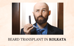Read more about the article Unlocking the Secrets of Beard Transplant in Kolkata: A Comprehensive Guide by Dr. Himadri Sinha￼