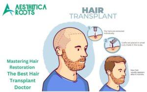 Read more about the article Mastering Hair Restoration | The Best Hair Transplant Doctor